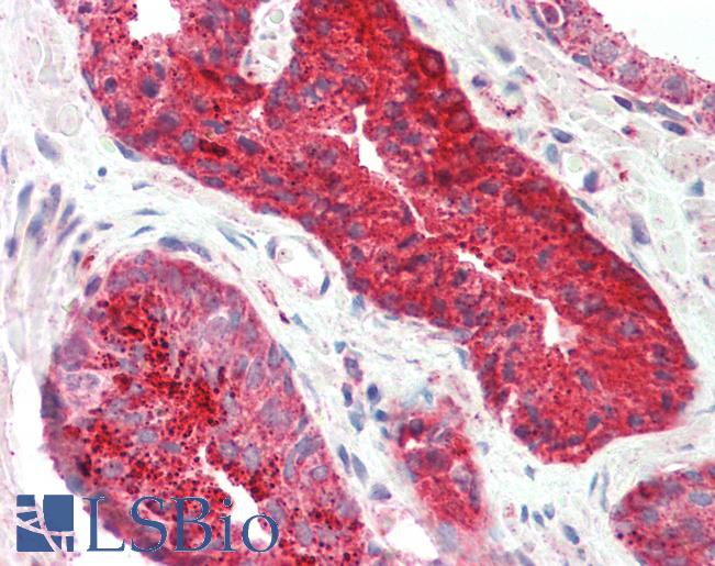 Anti-PDEF / SPDEF antibody IHC staining of human prostate. Immunohistochemistry of formalin-fixed, paraffin-embedded tissue after heat-induced antigen retrieval. Antibody LS-B10250 concentration 10 ug/ml.