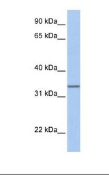Placenta lysate. Antibody concentration: 1.0 ug/ml. Gel concentration: 12%.