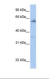 Hela cell lysate. Antibody concentration: 1.0 ug/ml. Gel concentration: 12%.