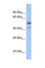 SPDEF antibody LS-C135069 Western blot of Fetal Muscle lysate. Antibody concentration 1 ug/ml.