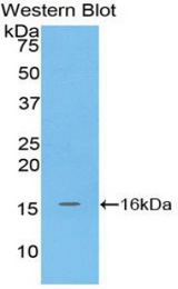 Western blot of recombinant MGP / Matrix Gla-Protein.