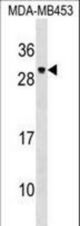 PDF Antibody western blot of MDA-MB453 cell line lysates (35 ug/lane). The PDF antibody detected the PDF protein (arrow).