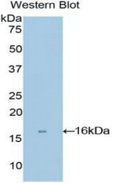 Western blot of recombinant MGP / Matrix Gla-Protein.