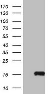 HEK293T cells were transfected with the pCMV6-ENTRY control (Left lane) or pCMV6-ENTRY MGP (Right lane) cDNA for 48 hrs and lysed. Equivalent amounts of cell lysates (5 ug per lane) were separated by SDS-PAGE and immunoblotted with anti-MGP.