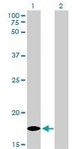Western blot of MCFD2 expression in transfected 293T cell line by MCFD2 monoclonal antibody (M01), clone 3A5-G4.
