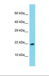 Western blot of Human Fetal Liver. PDGFC antibody dilution 1.0 ug/ml.
