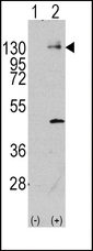 Western blot of PDGFRA (arrow) using rabbit polyclonal PDGFRA Antibody (Y720) (RB11101). 293 cell lysates (2 ug/lane) either nontransfected (Lane 1) or transiently transfected with the PDGFRA gene (Lane 2) (Origene Technologies).