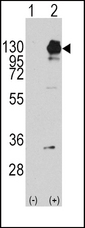 Western blot of PDGFRA (arrow) using rabbit polyclonal PDGFRA Antibody (Y754) (RB11213). 293 cell lysates (2 ug/lane) either nontransfected (Lane 1) or transiently transfected with the PDGFRA gene (Lane 2) (Origene Technologies).