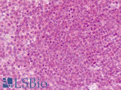 Human Tonsil: Formalin-Fixed, Paraffin-Embedded (FFPE)
