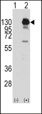 Western blot of PDGFRA (arrow) using rabbit polyclonal PDGFRA Antibody (Y762) (RB11109). 293 cell lysates (2 ug/lane) either nontransfected (Lane 1) or transiently transfected with the PDGFRA gene (Lane 2) (Origene Technologies).