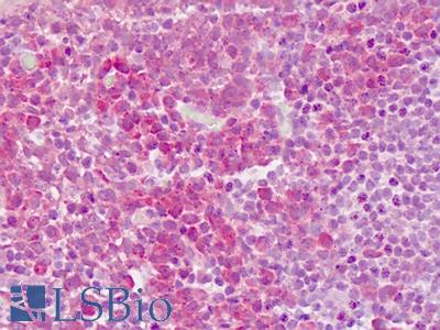 Human Tonsil: Formalin-Fixed, Paraffin-Embedded (FFPE)