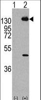 Western blot of PDGFRA (arrow) using rabbit polyclonal PDGFRA Antibody (Y768) (RB11119). 293 cell lysates (2 ug/lane) either nontransfected (Lane 1) or transiently transfected with the PDGFRA gene (Lane 2) (Origene Technologies).