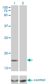 Western blot of MCFD2 over-expressed 293 cell line, cotransfected with MCFD2 Validated Chimera RNAi (Lane 2) or non-transfected control (Lane 1). Blot probed with MCFD2 monoclonal antibody, clone 3A5-G4. GAPDH ( 36.1 kD ) used as specific.