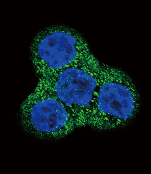 Confocal immunofluorescent of PDGFRB Antibody with WiDr cell followed by Alexa Fluor 488-conjugated goat anti-rabbit lgG (green). DAPI was used to stain the cell nuclear (blue).