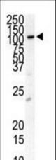 Western blot of anti-PDGFRB Antibody in cell line lysates (35 ug/lane). PDGFRB(arrow) was detected using the purified antibody).