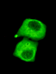 Immunocytochemistry of HeLa cells using anti- Pyruvate Dehydrogenase (C-terminus) antibody diluted 1:150.