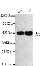 PDHA1 (C-terminus) antibody at 1/3000 dilution Lane1:A549 whole cell lysate 40 ug/Lane Lane2: HeLa whole cell lysate 40 ug/Lane.