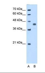 Lane A: Marker. Lane B: HepG2 cell lysate. Antibody concentration: 5.0 ug/ml. Gel concentration: 12%.
