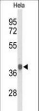 Western blot of PDHA1 Antibody in HeLa cell line lysates (35 ug/lane). PDHA1 (arrow) was detected using the purified antibody.