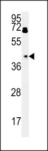 BDHA1 Antibody western blot of HepG2 cell line lysates (15 ug/lane). The BDHA1 antibody detected the BDHA1 protein (arrow).