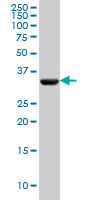 PDHB monoclonal antibody (M03), clone 2B2 Western blot of PDHB expression in HeLa.