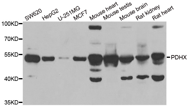 Western blot analysis of extracts of various cell lines, using PDHX antibody.