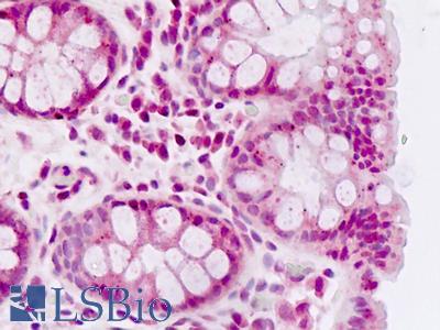 Human Colon: Formalin-Fixed, Paraffin-Embedded (FFPE)