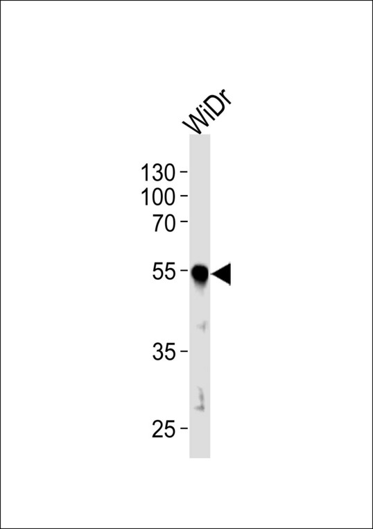 Western blot of lysate from WiDr cell line, using hPDX1R444. Antibody was diluted at 1:1000 at each lane. A goat anti-rabbit IgG H&L (HRP) at 1:5000 dilution was used as the secondary antibody. Lysate at 35ug per lane.