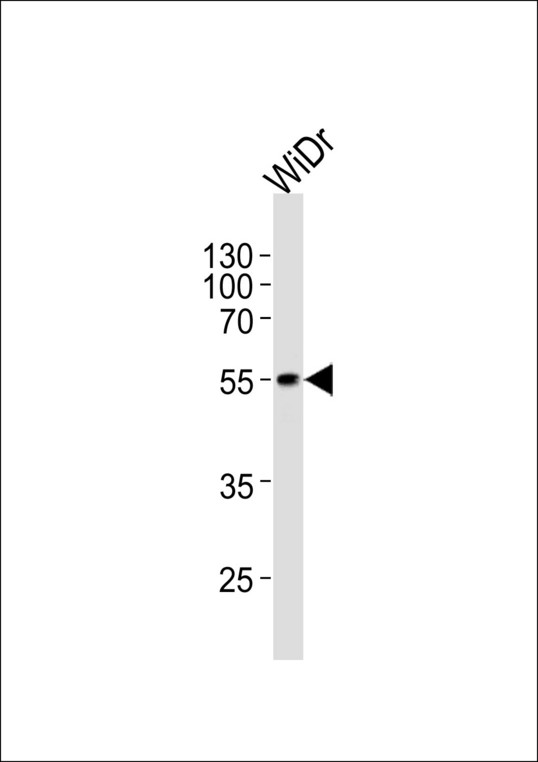 Western blot of lysate from WiDr cell line, using hPDX1R444. Antibody was diluted at 1:1000 at each lane. A goat anti-rabbit IgG H&L (HRP) at 1:5000 dilution was used as the secondary antibody. Lysate at 35ug per lane.