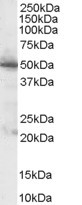 (1 ug/ml) Staining of Human Pancreas lysate (35 ug protein in RIPA buffer). Primary incubation was 1 hour. Detected by chemiluminescence.
