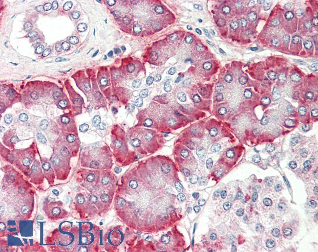 Human, Pancreas: Formalin-Fixed Paraffin-Embedded (FFPE)
