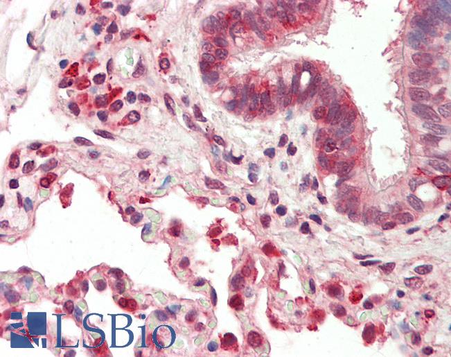 Human, Lung: Formalin-Fixed Paraffin-Embedded (FFPE)