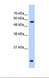 HepG2 cell lysate. Antibody concentration: 0.25 ug/ml. Gel concentration: 12%.