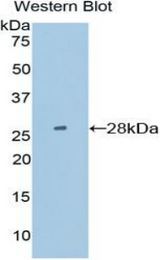 Western blot of recombinant PDIA2.