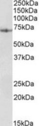 PDIA2 antibody (0.03 ug/ml) staining of Human Pancreas lysate (35 ug protein/ml in RIPA buffer). Primary incubation was 1 hour. Detected by chemiluminescence.