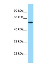 PDIA3 / ERp57 antibody LS-C146188 Western blot of Fetal Kidney lysate. Antibody concentration 1 ug/ml.