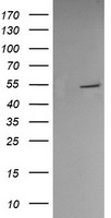 HEK293T cells were transfected with the pCMV6-ENTRY control (Left lane) or pCMV6-ENTRY PDIA3 (Right lane) cDNA for 48 hrs and lysed. Equivalent amounts of cell lysates (5 ug per lane) were separated by SDS-PAGE and immunoblotted with anti-PDIA3.