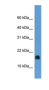 MGST1 antibody LS-C135773 Western blot of Fetal Liver lysate.