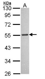 Sample (30 ug of whole cell lysate). A: IMR32 10% SDS PAGE. SLC1 / MCHR1 antibody diluted at 1:1000.
