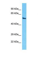 Western blot of Human HepG2. PDIA5 antibody dilution 1.0 ug/ml.
