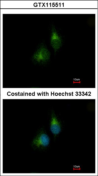 Immunofluorescence of methanol-fixed A549 using PDIR antibody at 1:200 dilution.