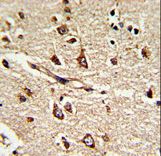 Formalin-fixed and paraffin-embedded human brain tissue reacted with PDIA6 Antibody (Center K159), which was peroxidase-conjugated to the secondary antibody, followed by DAB staining. This data demonstrates the use of this antibody for immunohistochemistry; clinical relevance has not been evaluated.