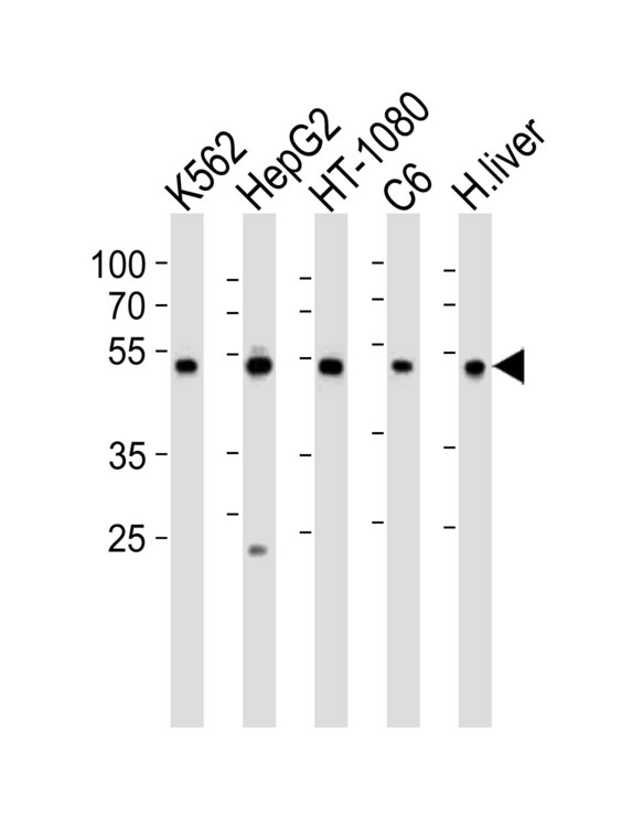 Western blot of lysates from K562, HepG2, HT-1080, rat C6 cell line and human liver tissue lysate (from left to right), using PDIA6 Antibody (Center K159). Antibody was diluted at 1:1000 at each lane. A goat anti-rabbit IgG H&L (HRP) at 1:10000 dilution was used as the secondary antibody. Lysates at 35ug per lane.