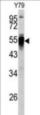 Western blot of PDIA6 antibody (Center K159) in Y79 cell line lysates (35 ug/lane). PDIA6 (arrow) was detected using the purified antibody.