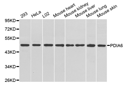 Western blot analysis of extracts of various cell lines, using PDIA6 antibody.