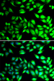 Immunofluorescence blot of U20S cell using PDIA6 antibody. Blue: DAPI for nuclear staining.