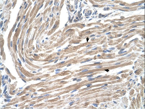 MGST2 antibody LS-C80706 was used in IHC to stain formalin-fixed, paraffin-embedded human muscle.
