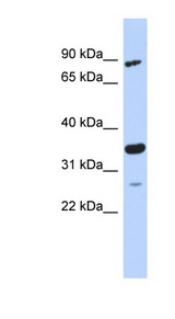 PDIK1L antibody LS-C111477 Western blot of MCF7 cell lysate.