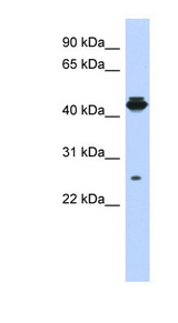 PDIK1L antibody LS-C102520 Western blot of MCF7 cell lysate.