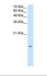 HepG2 cell lysate. Antibody concentration: 1.25 ug/ml. Gel concentration: 15%.